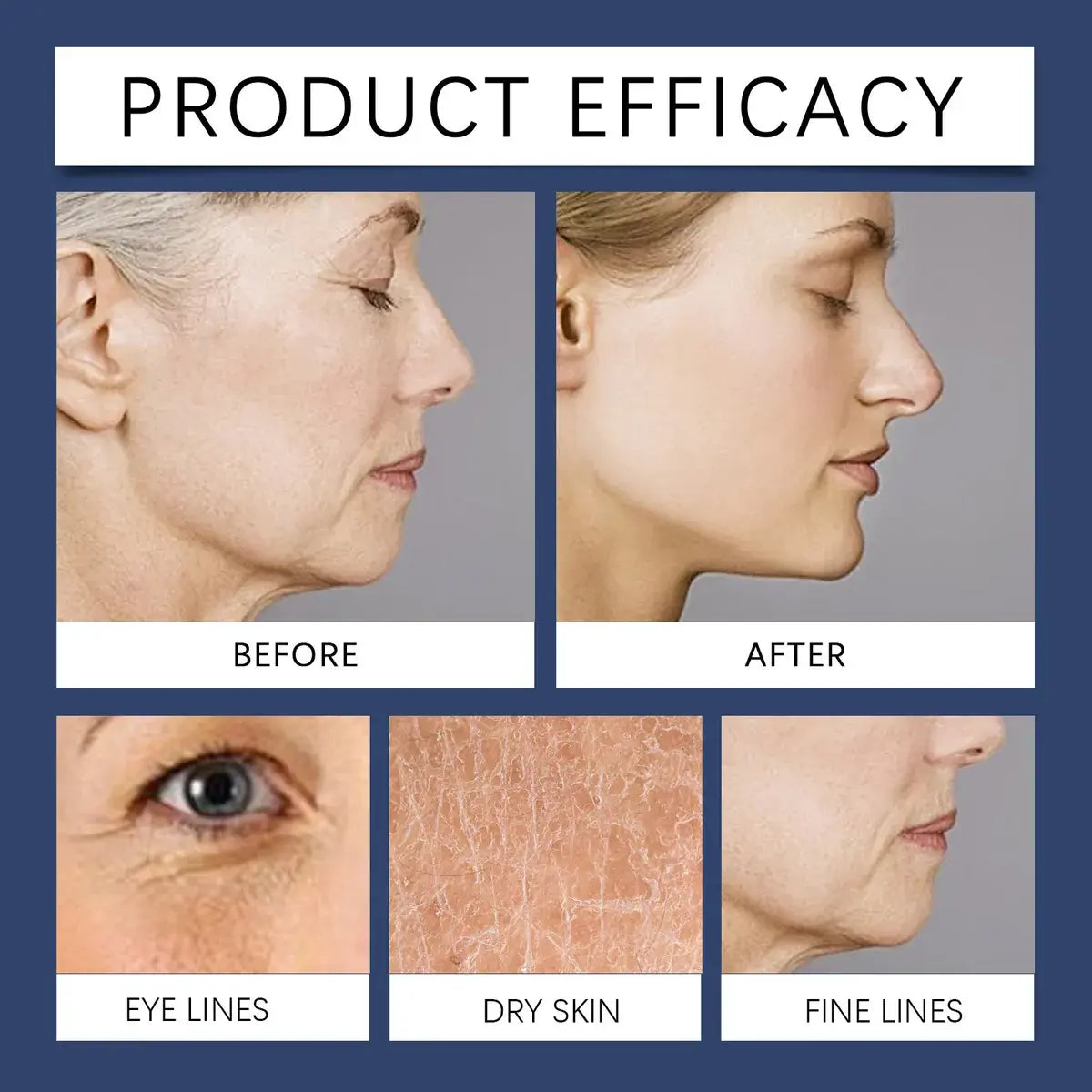 Skindes Crema Reafirmante Antiarrugas con Péptidos