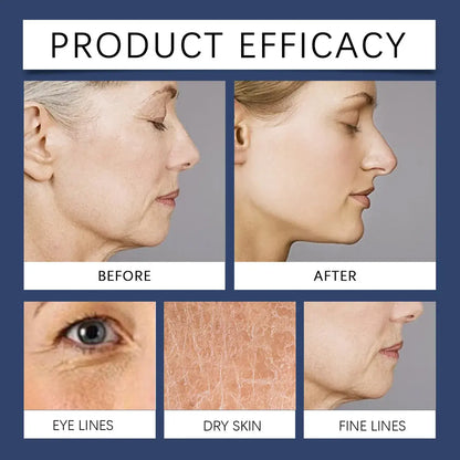 Skindes Crema Reafirmante Antiarrugas con Péptidos